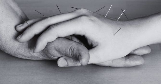 Community Acupuncture: Healing in a Shared Space image